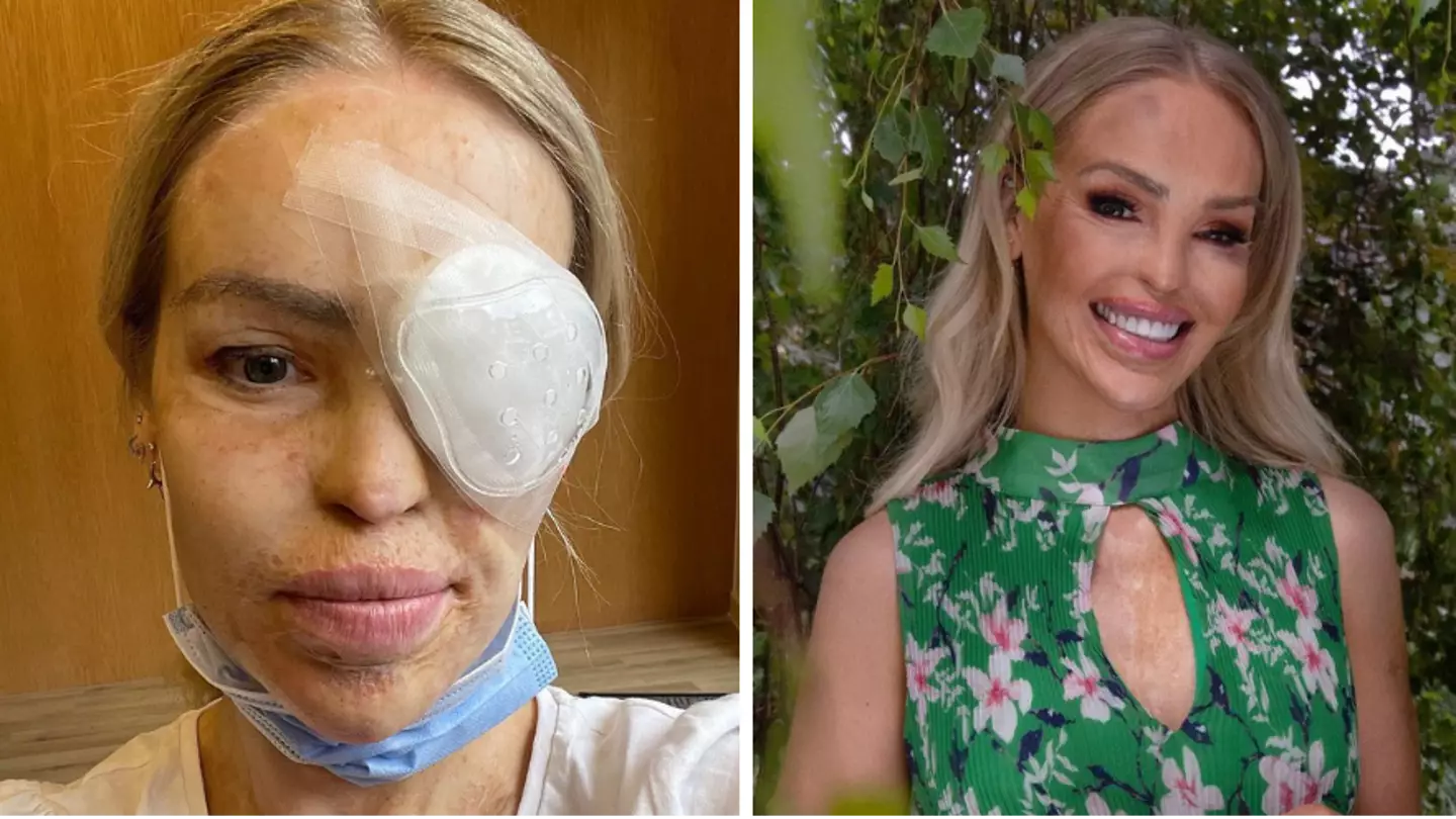 Katie Piper rushed to hospital after husband noticed black spot in her eye