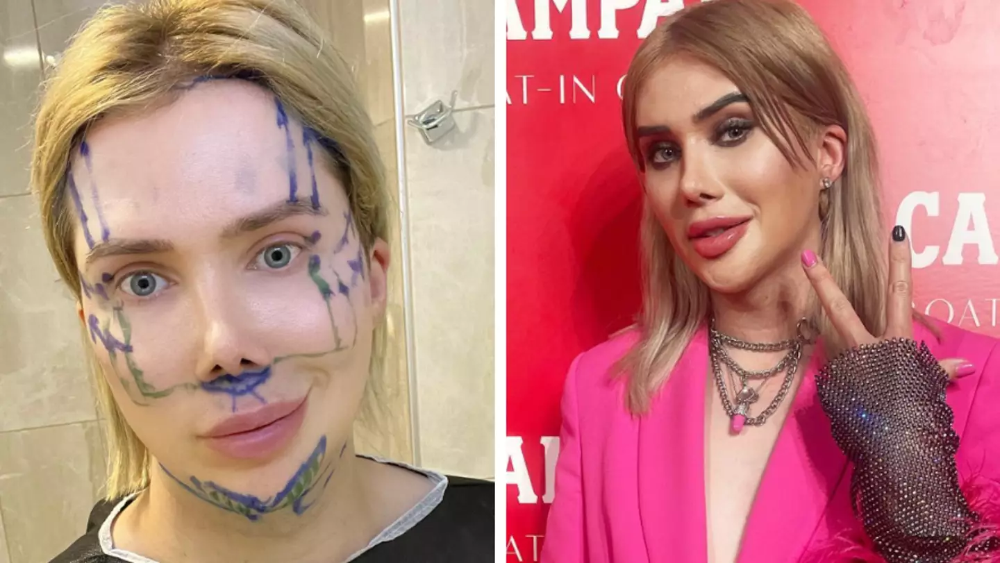Influencer who regrets spending £250,000 on surgery to look like Barbie is now 'living as Ken'
