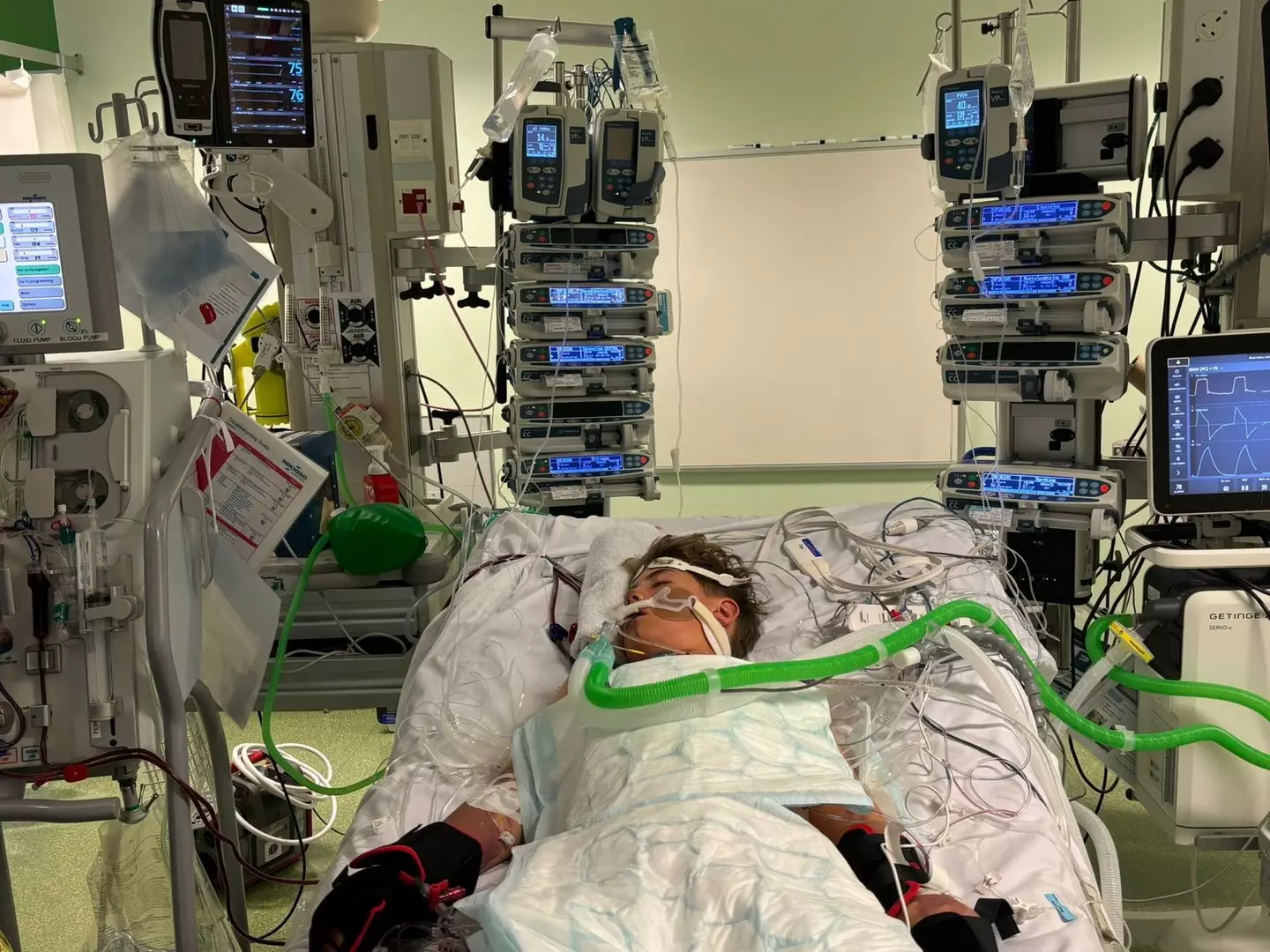 Things soon deteriorated for Austin, with him being placed into an induced coma (SWNS)