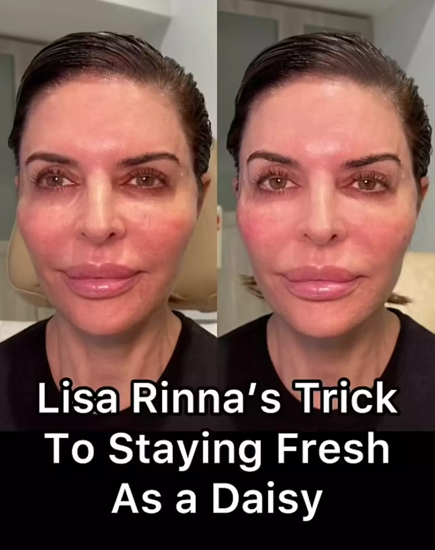 Lisa before and after SkinVive. (TikTok/@francinequeenofthreads_)