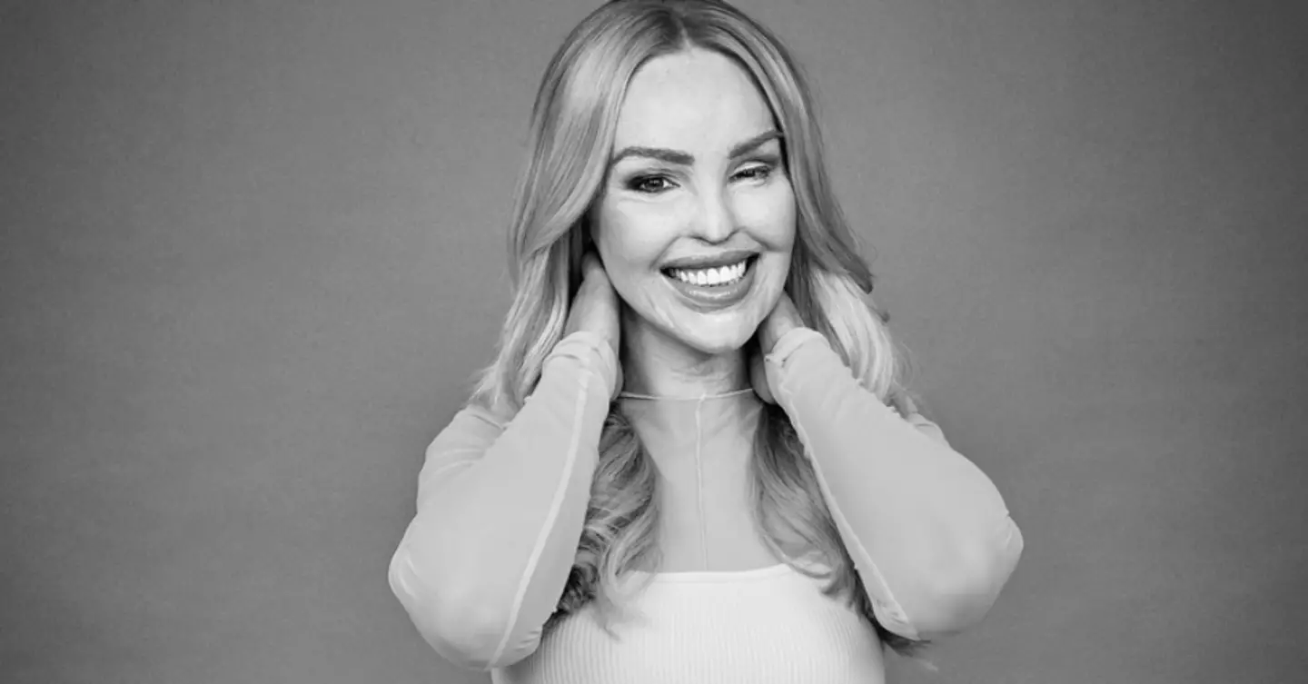 Katie meets inspiring, positive people every week through her burns charity.