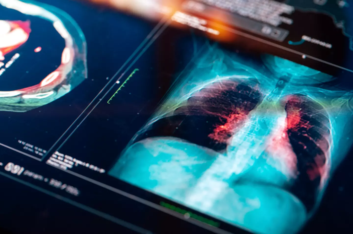 Experts say more needs to be done to raise awareness of the symptoms (Getty Stock Image)