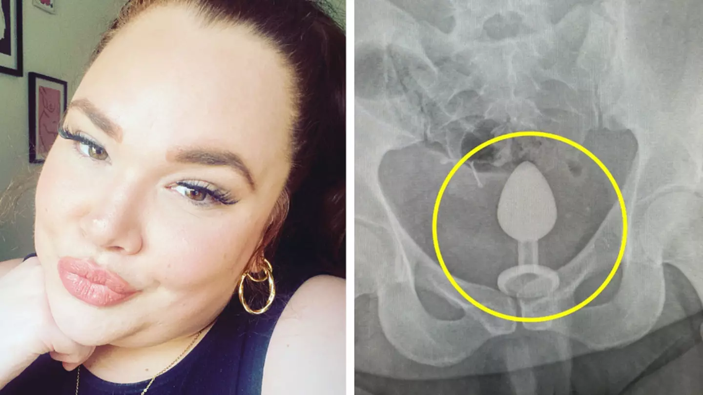 'Mortified' woman rushed to A&E after getting adult toy stuck inside her