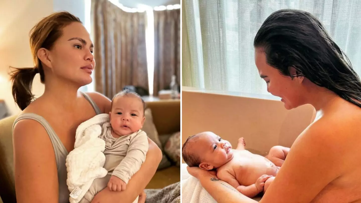 Instagram/@chrissyteigen