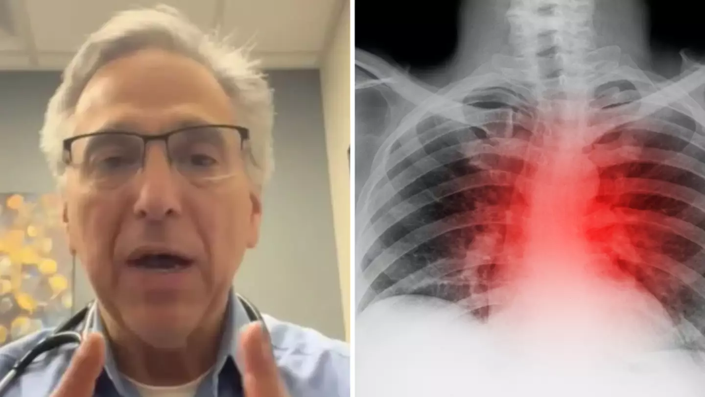 Cardiologist reveals his number one tips to avoid a heart attack before you’re 60