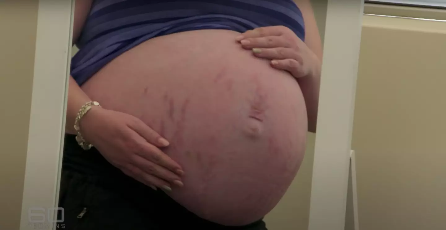 Kim was shocked when she was told there were five heartbeats.