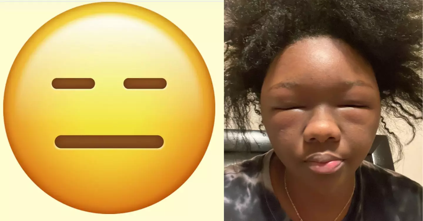 She said she looked like an emoji.