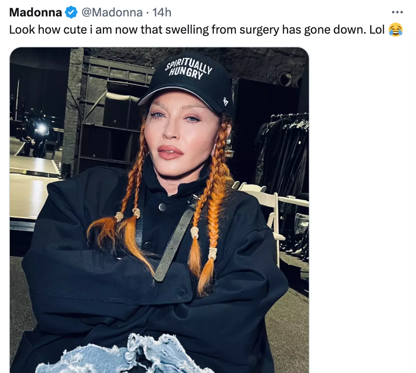 Madonna said she'd had surgery.