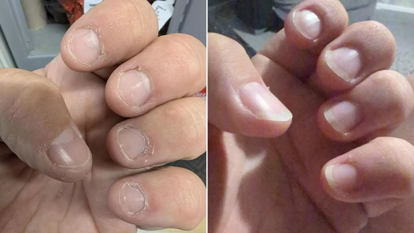 People say they've seen nail growth after just 'five weeks' (Amazon reviews)