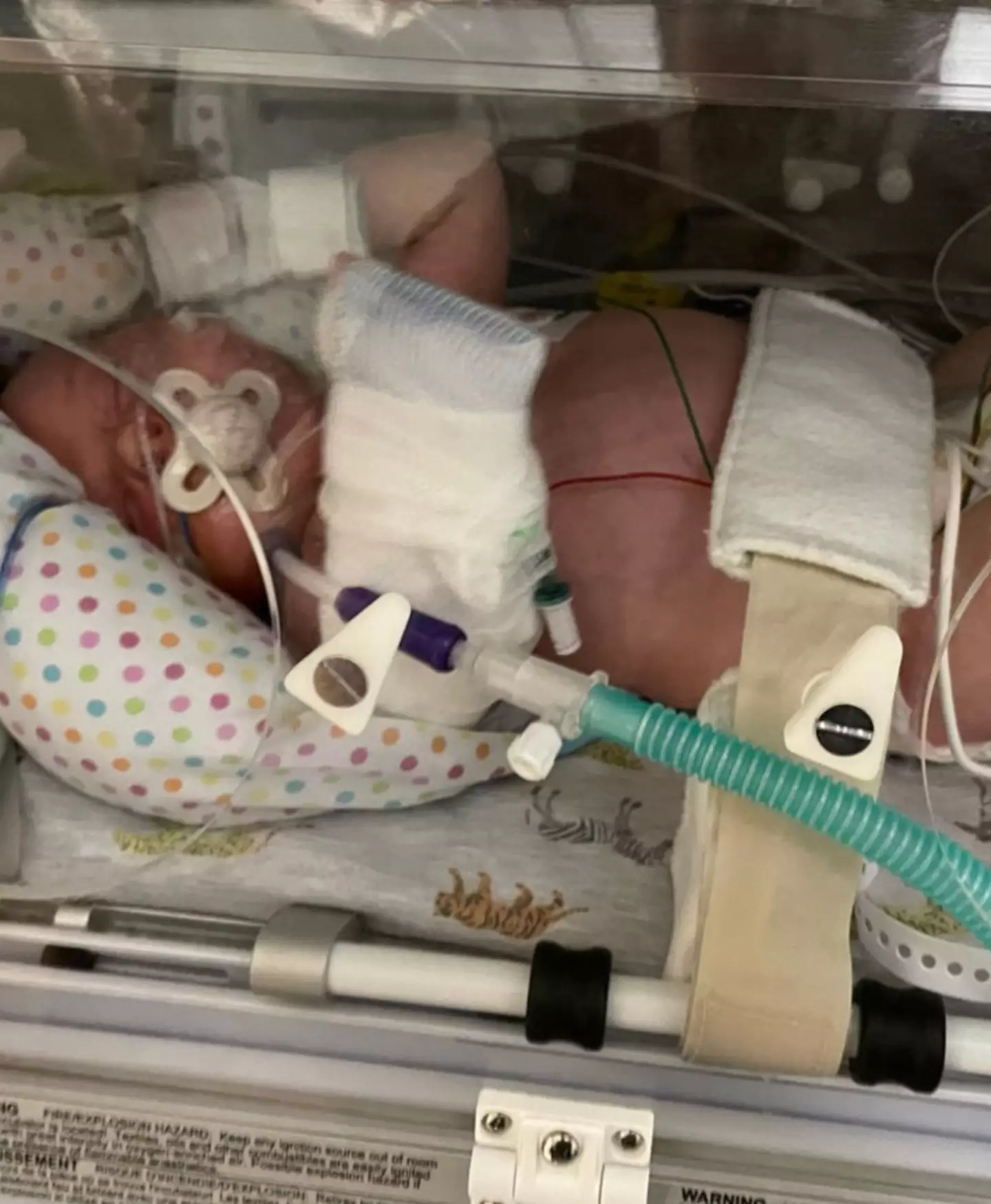 Alfie became seriously ill.