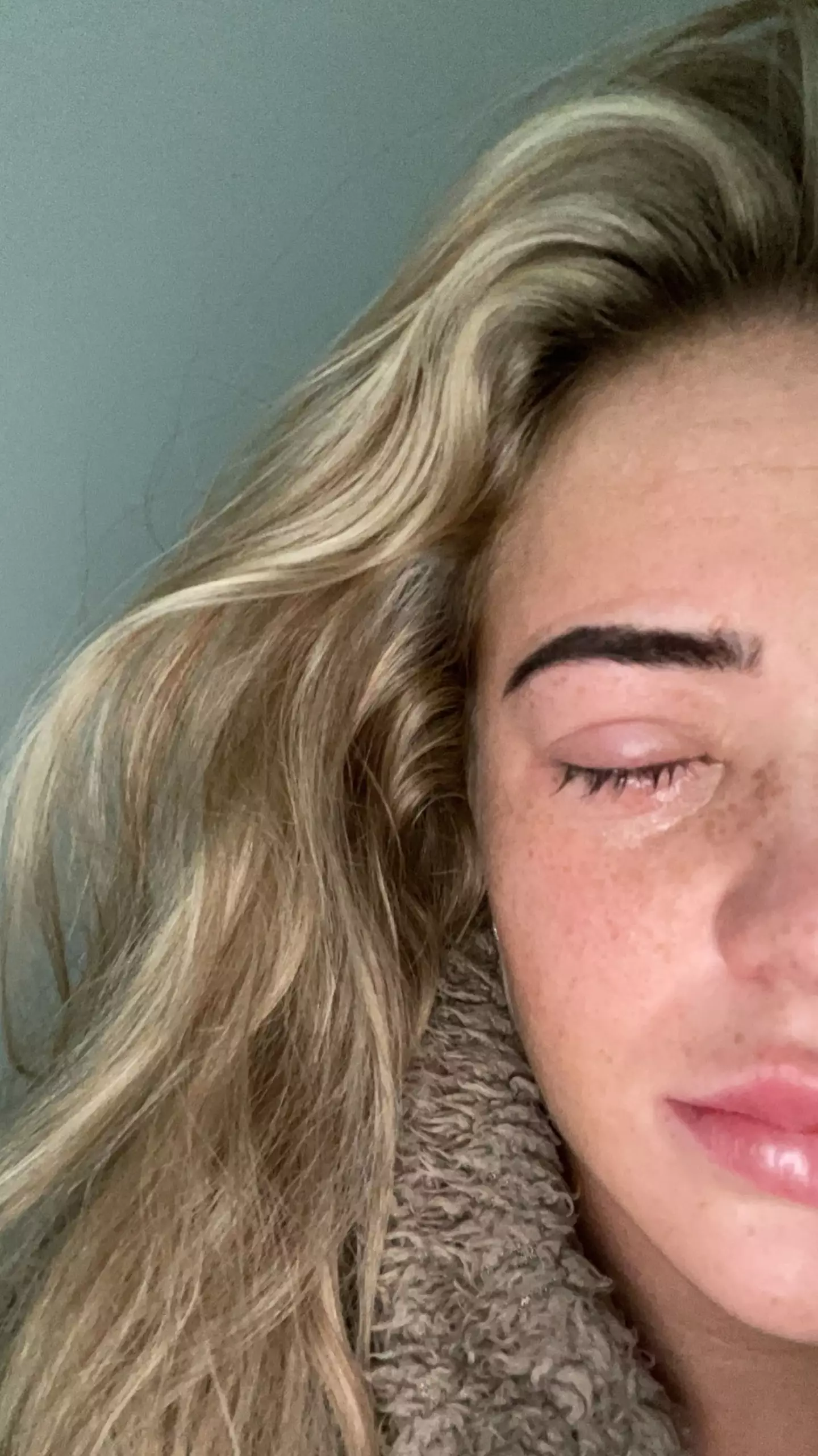 Her eye started swelling six hours after her appointment. (Kennedy)