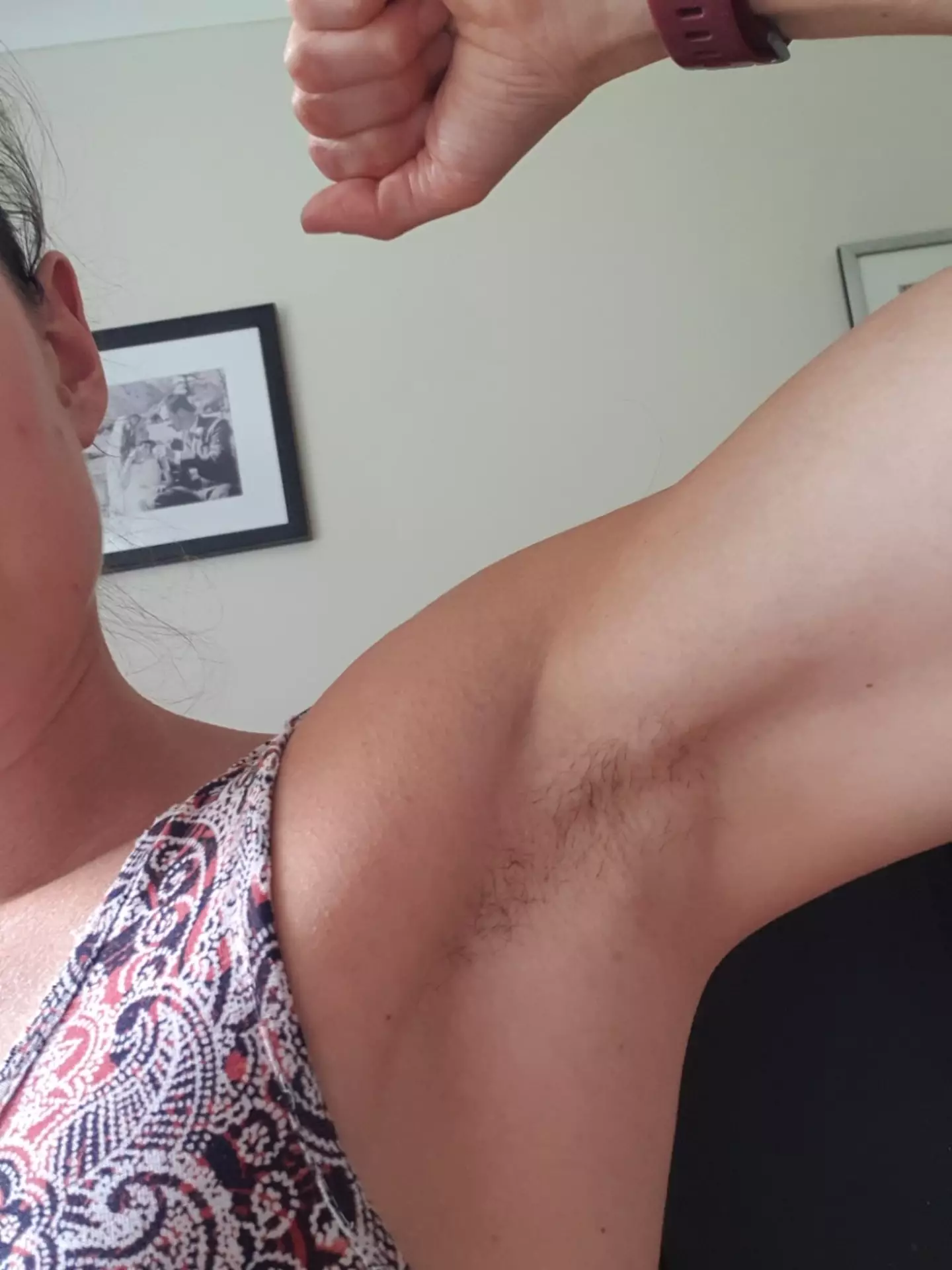 "I don't really care what or how it looks. It's more about that I don't have the rash and the itchiness under my arms," Becky said.