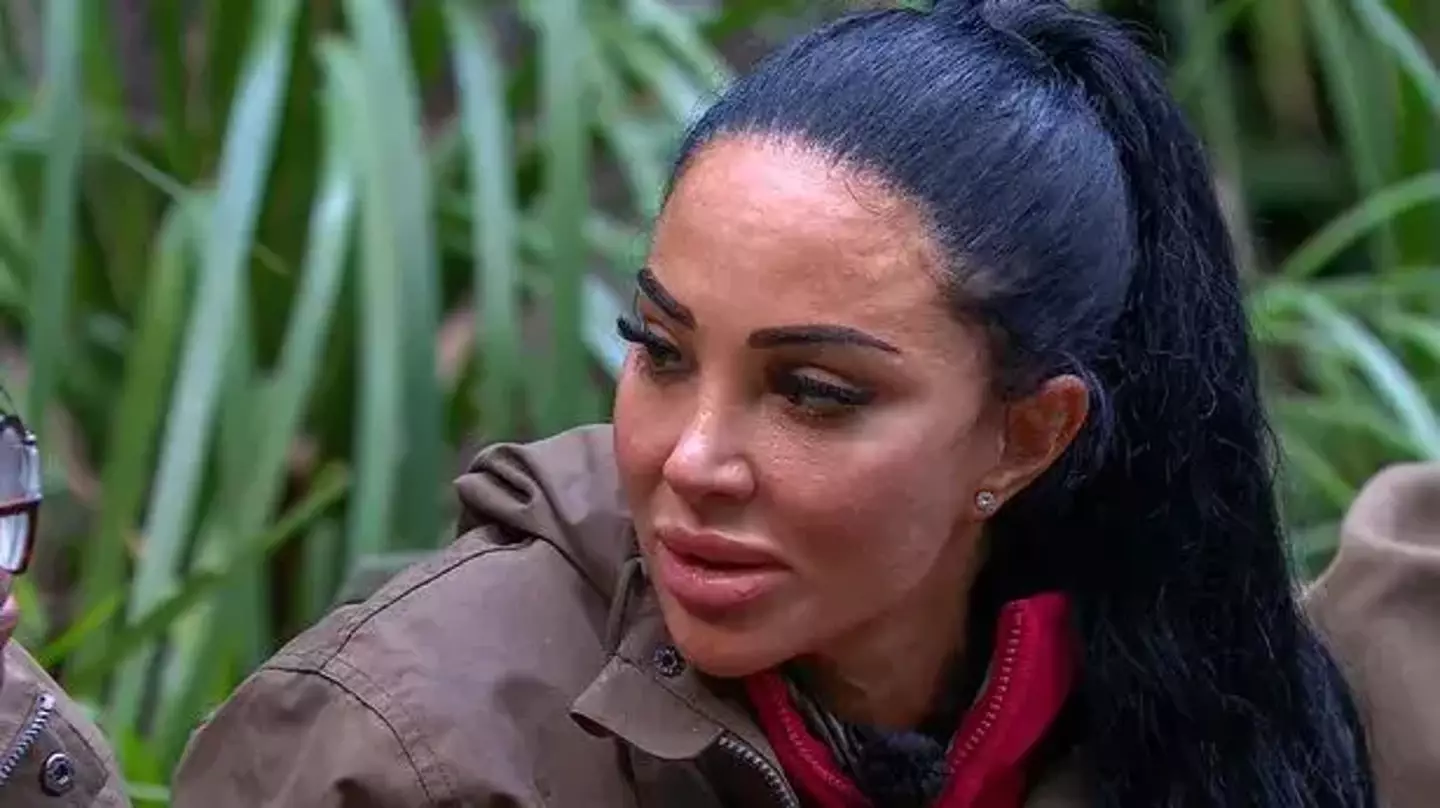 Tulisa was diagnosed with Bell's palsy back in 2020 (ITV)