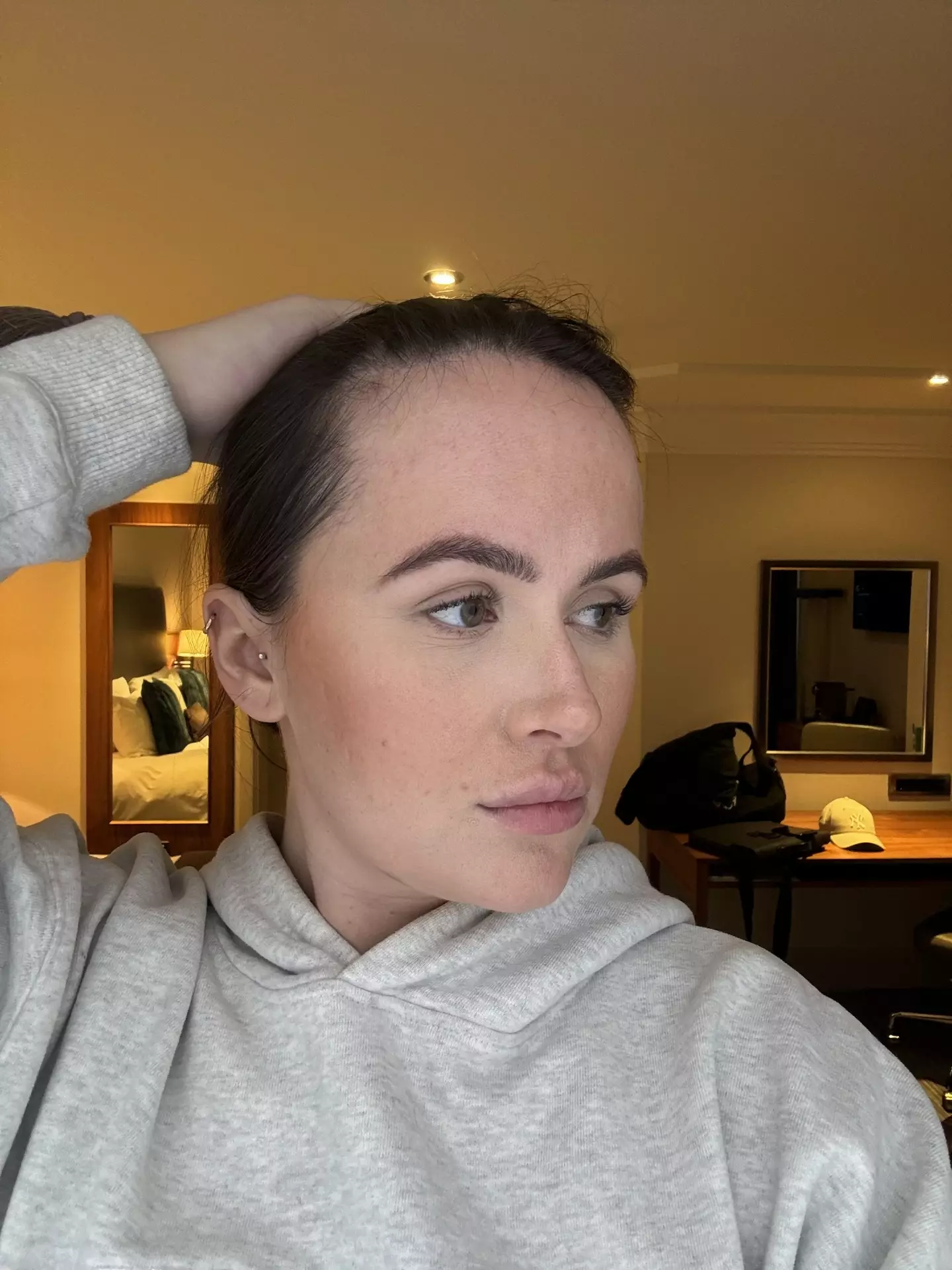 The 27-year-old opened up about being bullied for her 'fivehead' in school.