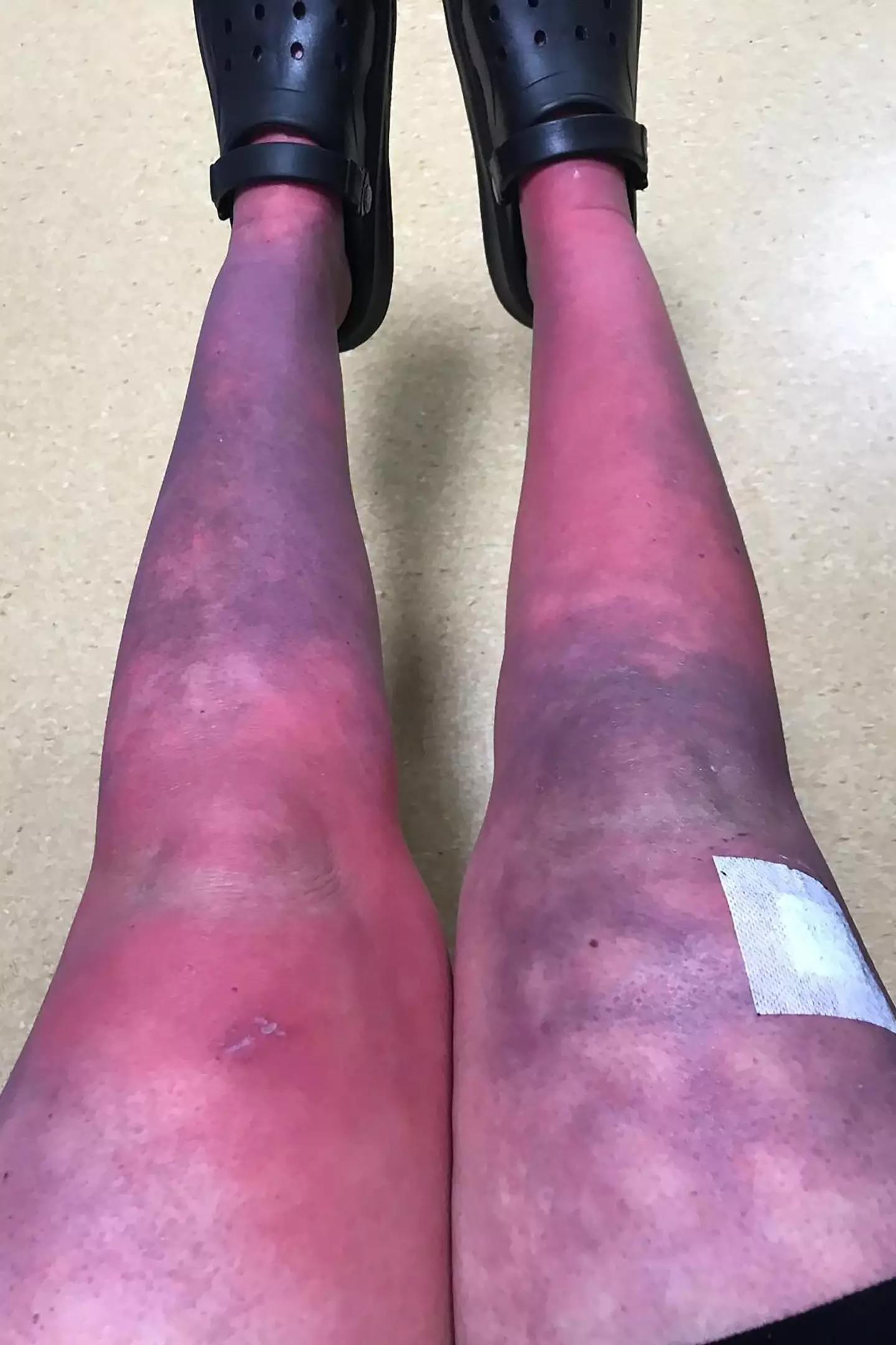 Rachel's husband said the lack of care she has received has been 'frustrating' (PA Real Life)