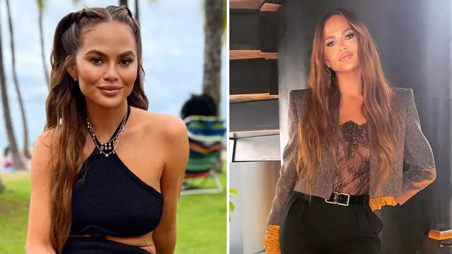 Chrissy Teigen Shuts Down Claim She Has ‘Constant Liposuction’