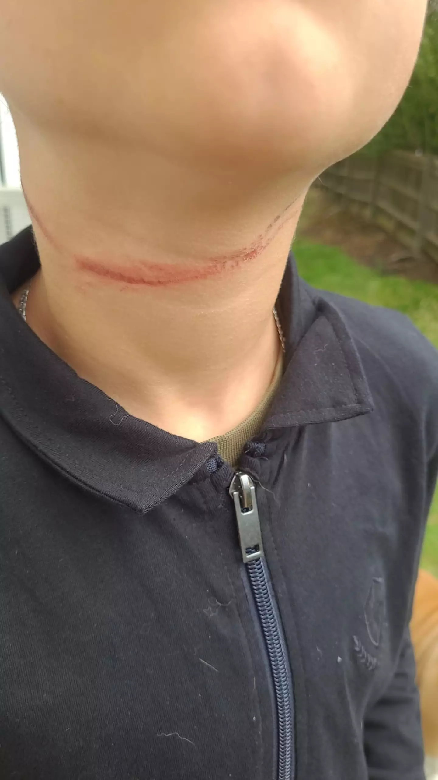 He got caught in a fly curtain last week.