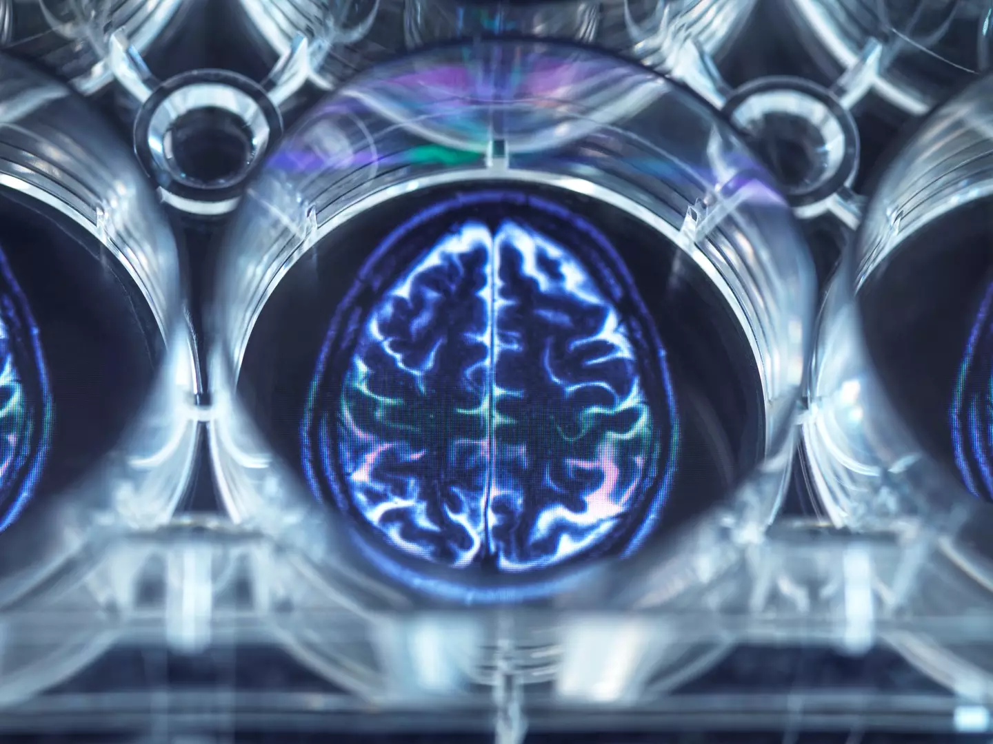 Alzheimer's is the start of brain function and memory loss (Getty Stock Images)