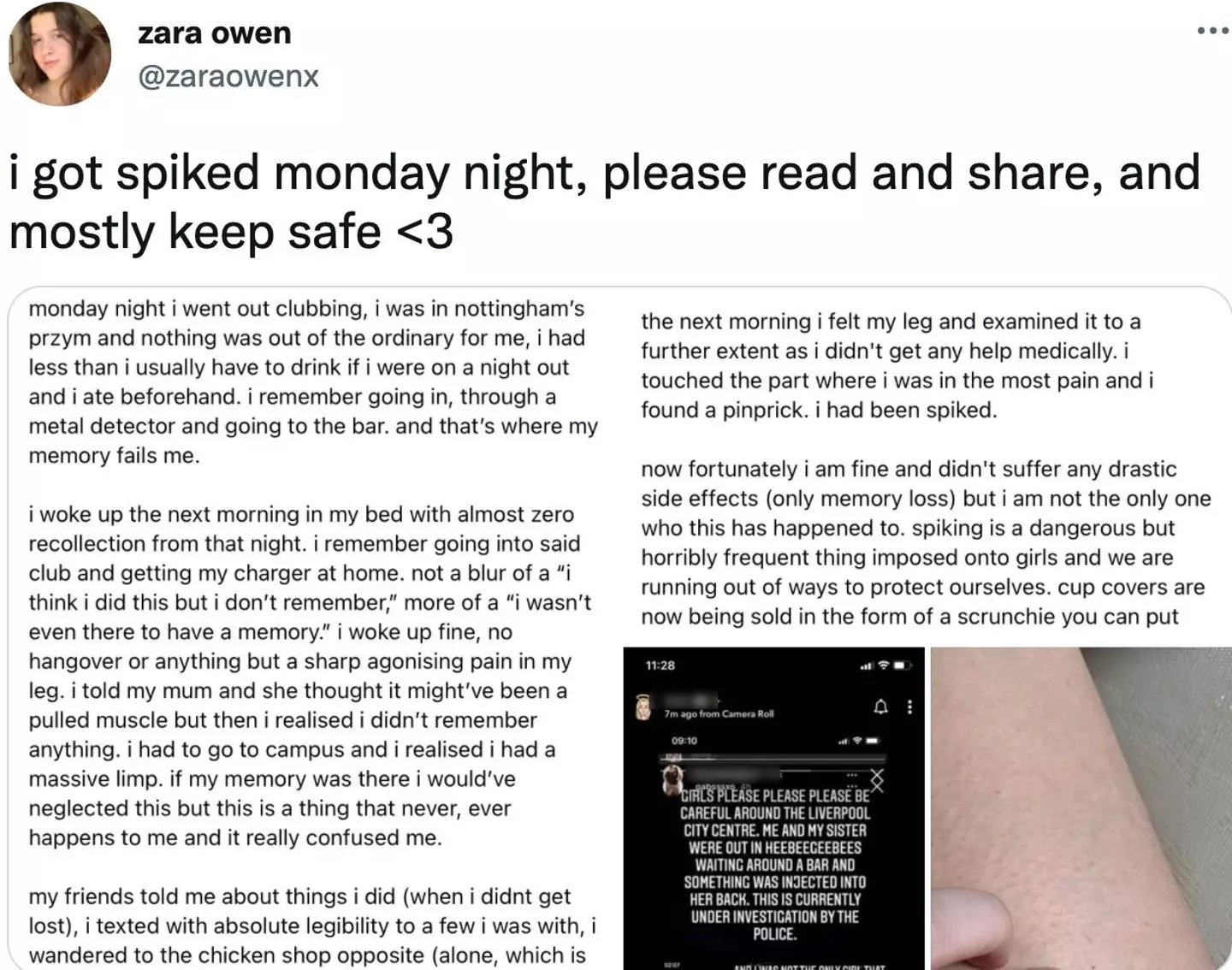 Zara shared her story on Twitter (