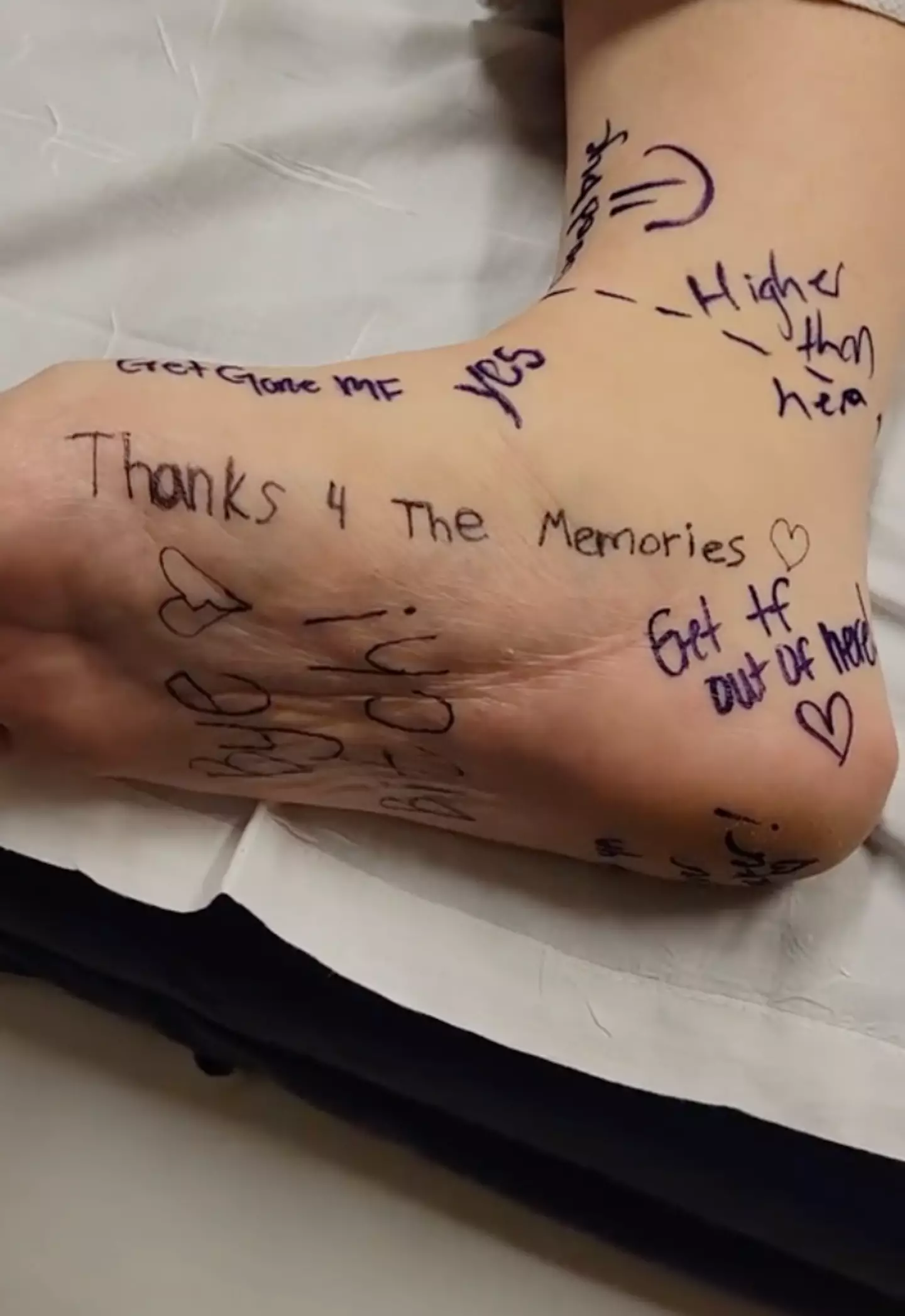 People wrote messages on Sierra's foot.