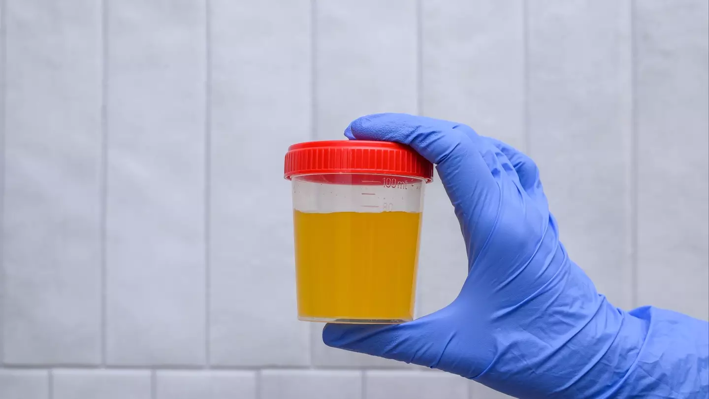 The colour of your wee could actually reveal how stressed you are
