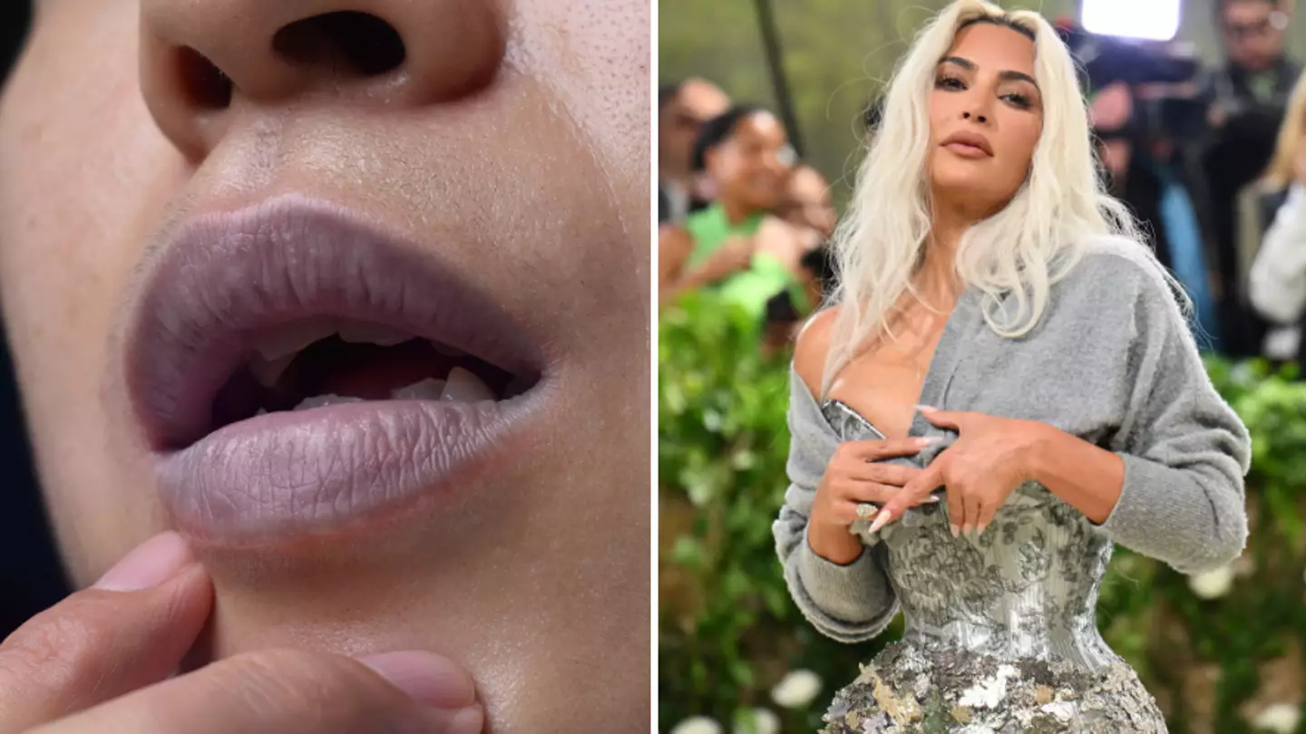 NHS official advice on 'serious' health problem after fans spot Kim Kardashian's 'blue lips' at Met Gala