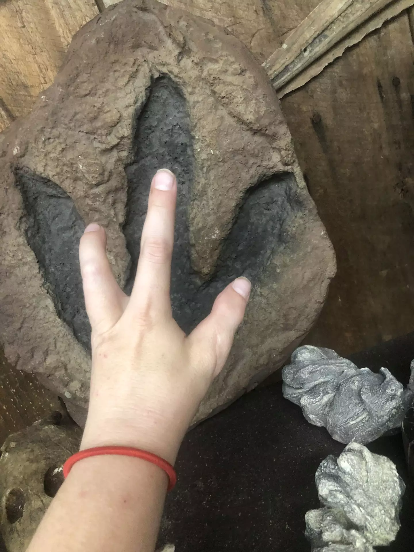 Cassidy said there's some challenges with having three fingers.