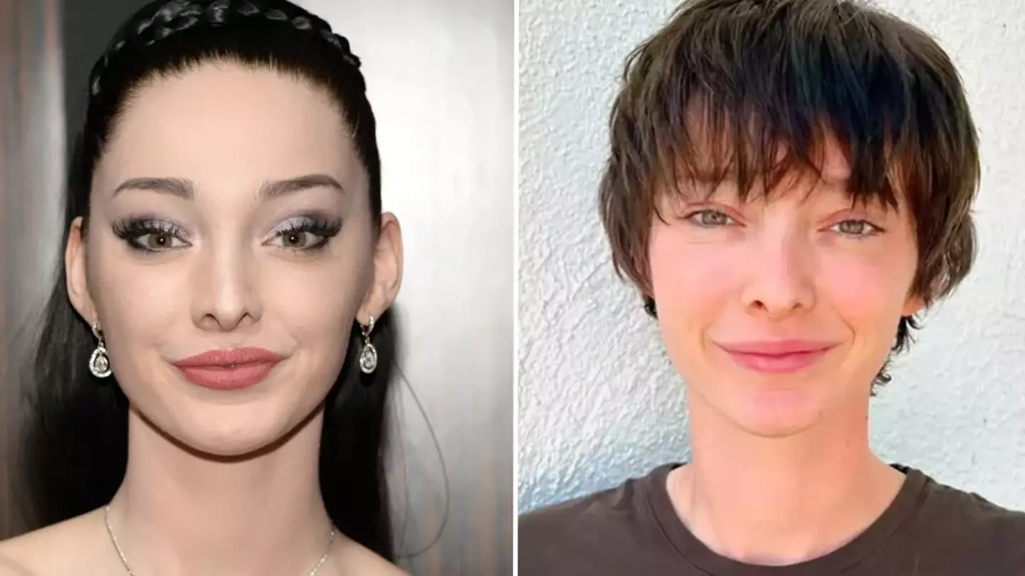 Oppenheimer star Nick Dumont speaks out for first time since coming out as trans and revealing new name