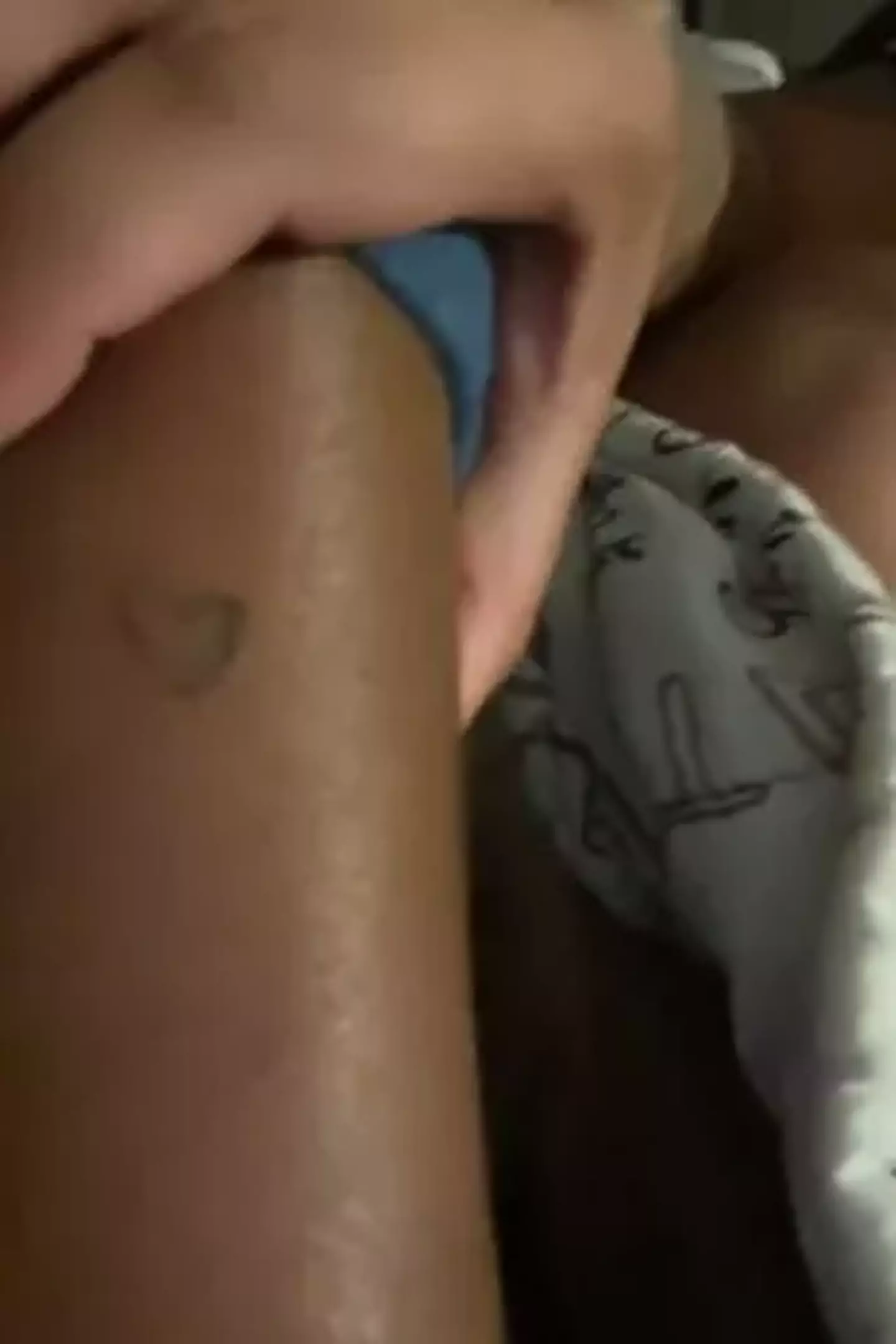 Here's what she found on her daughter's leg.