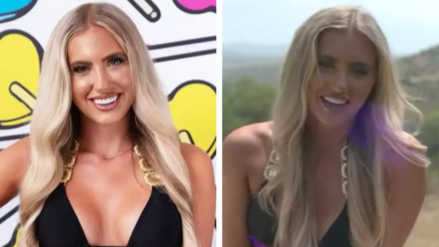 Love Island: Mollie Salmon’s Family Apologise Over Allergy Comment