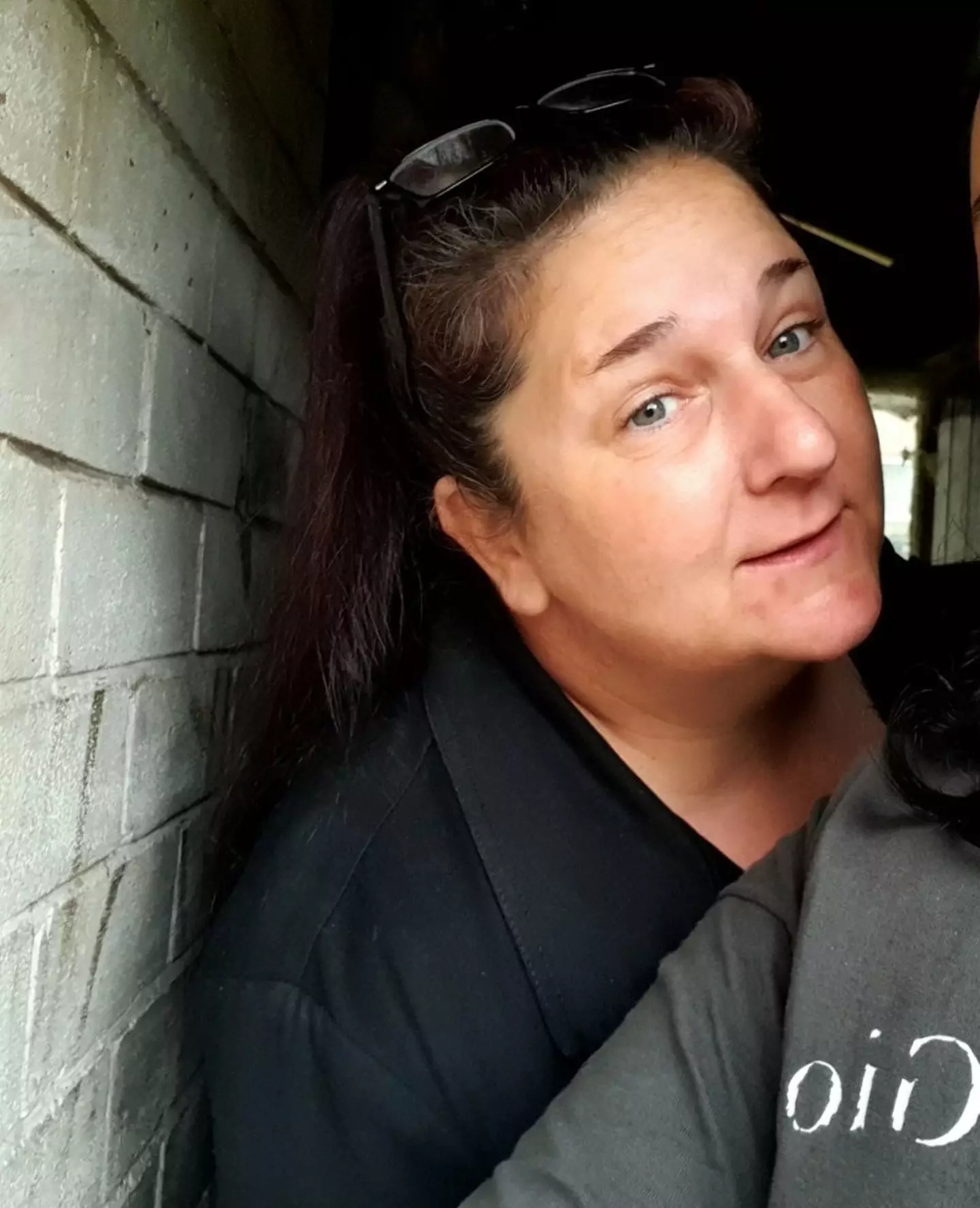 Lindsey Thwaites started experiencing soreness and bleeding earlier this year.