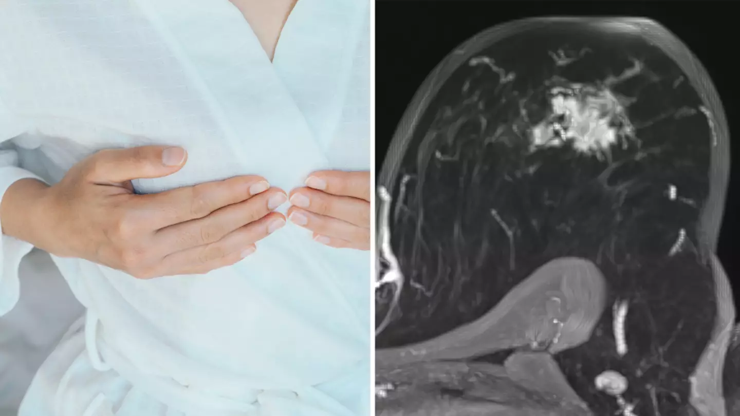 Seven 'silent killer' warning signs women need to look out for that could be signs of breast cancer