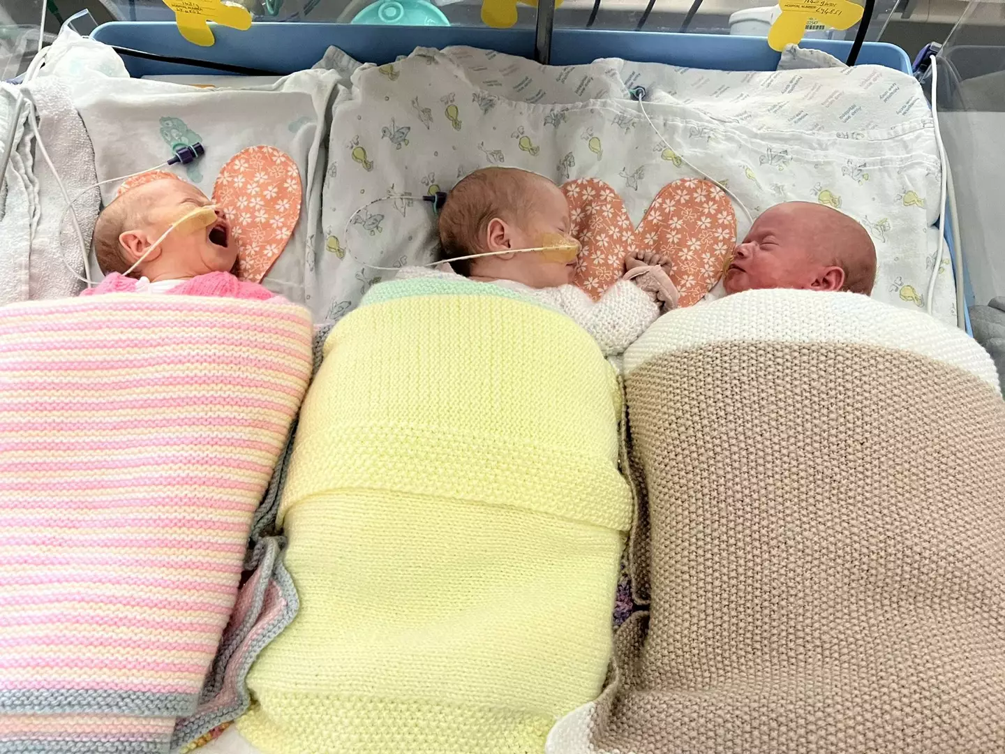 Little Thea, Lily and Esmae originally had boys' names.