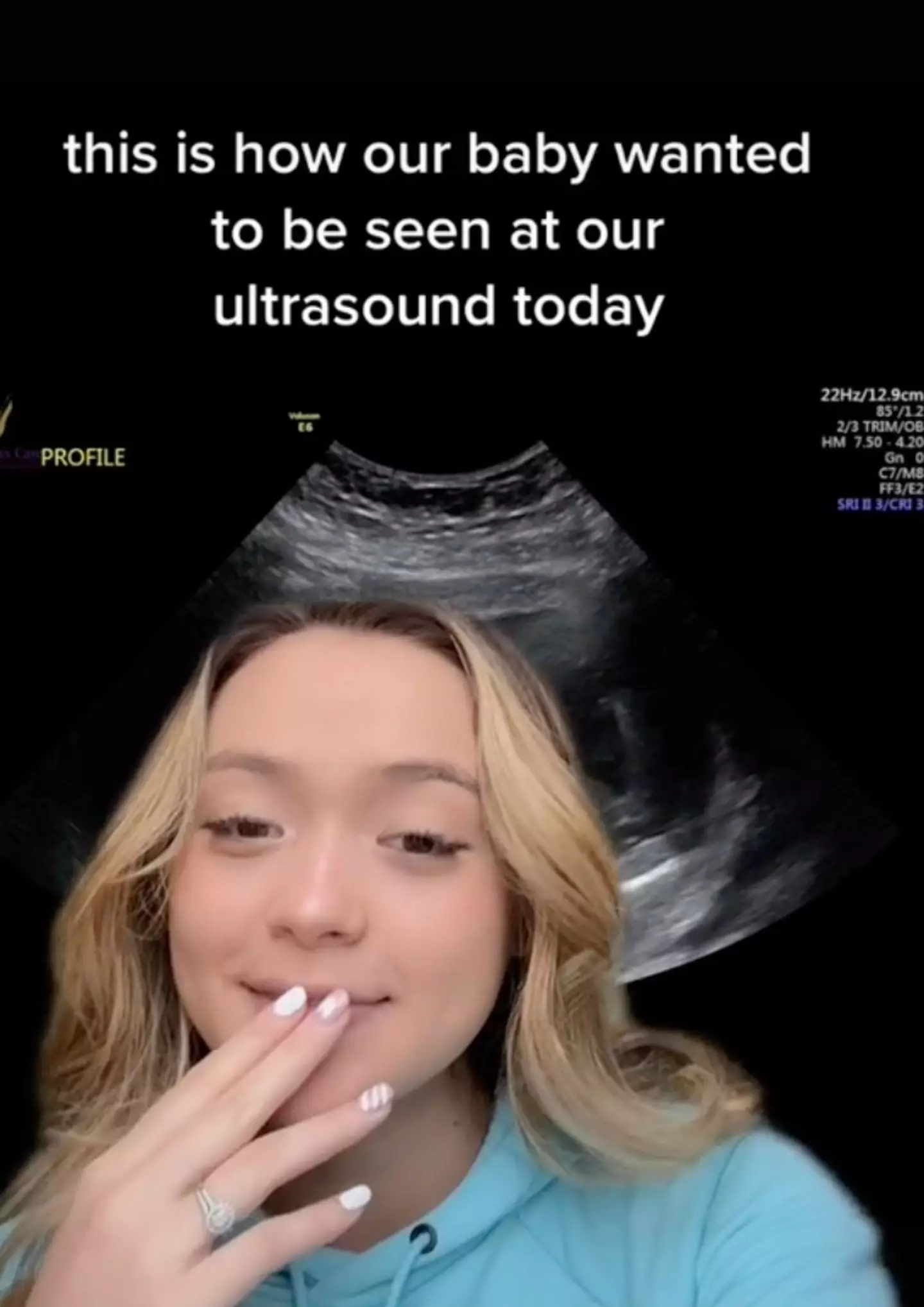 The mum-to-be was not expecting her ultrasound to look like that. (