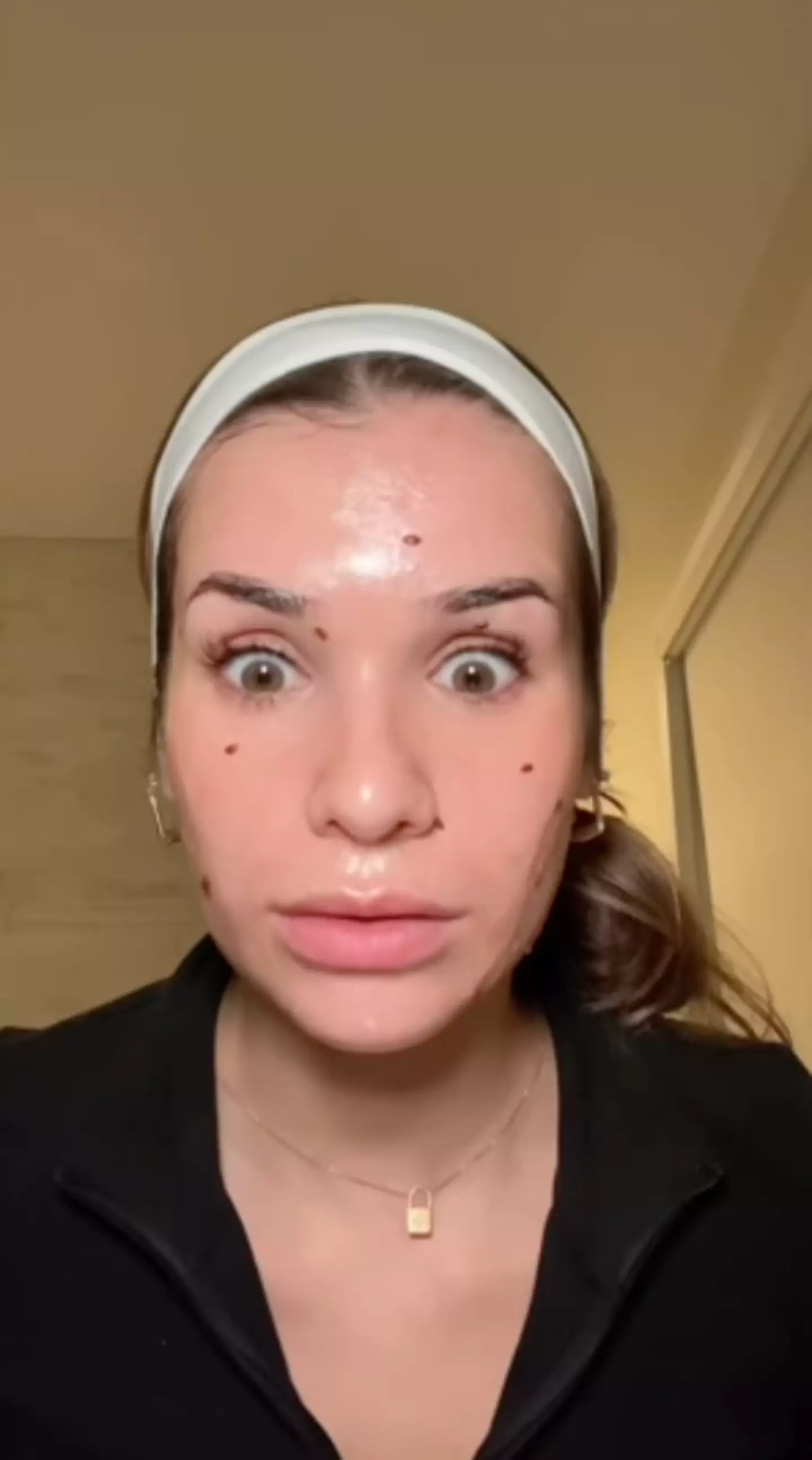 The woman was unable to move her face.