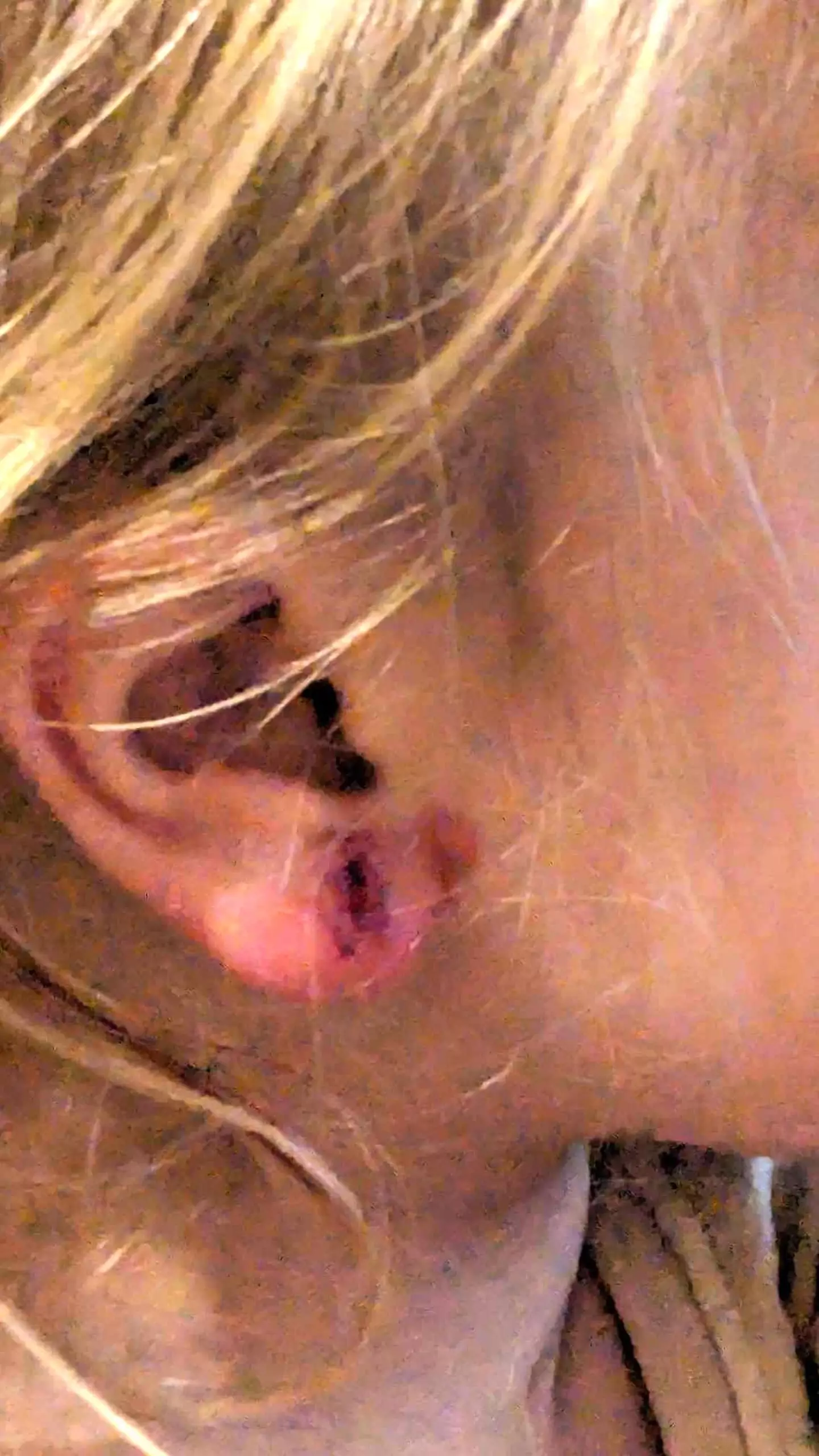 Jessica found 'two large gouges' in her daughter's ear lobes.