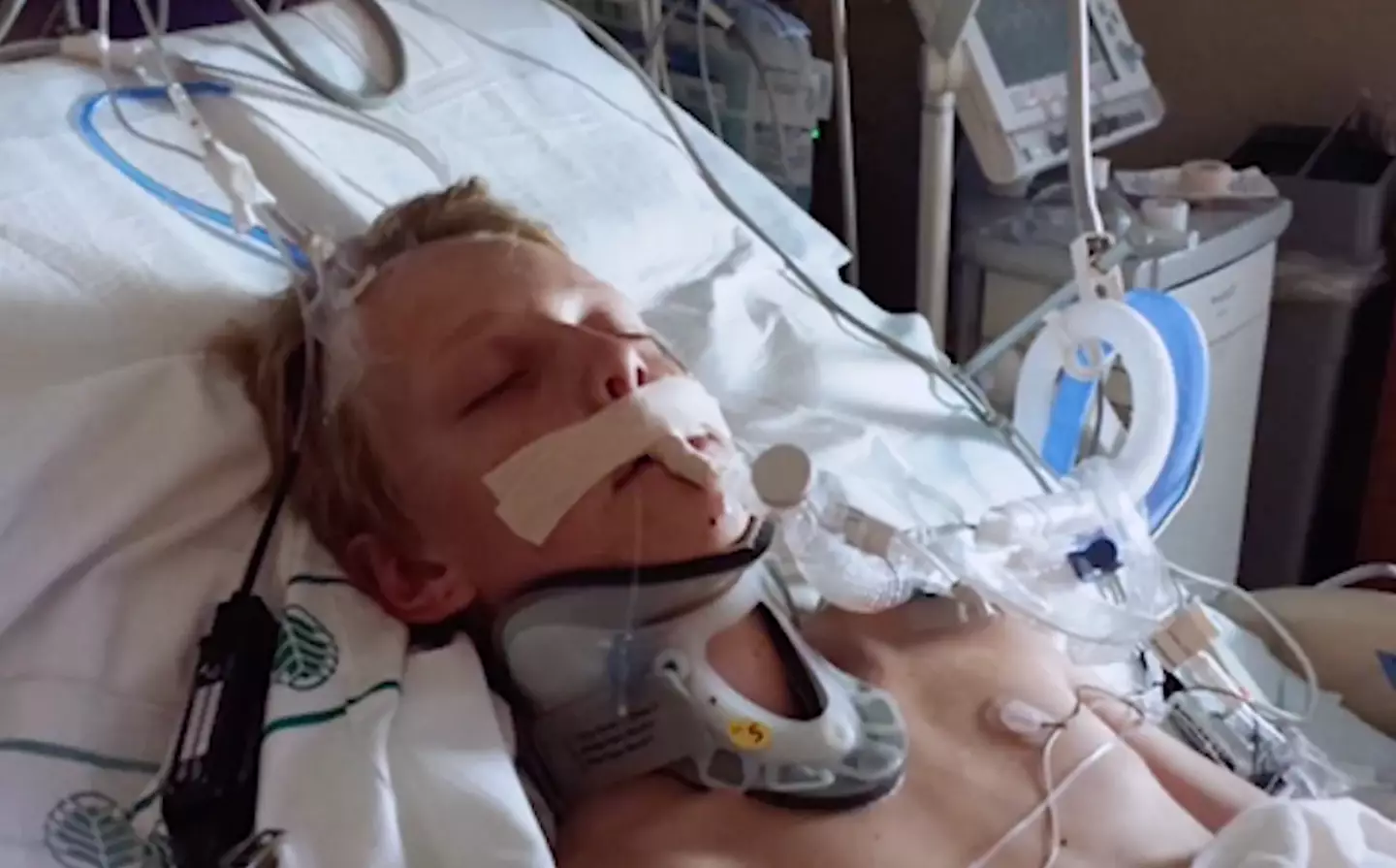 Micah was in a coma for months.