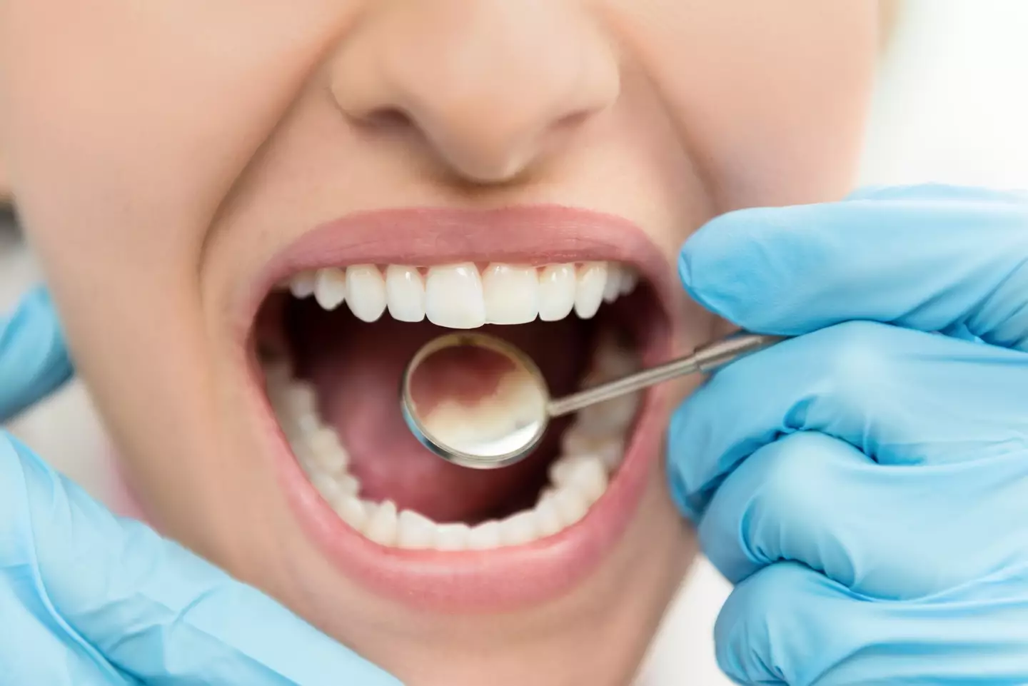Have you ever noticed your teeth appearing see-through? (yoh4nn/Getty Images)