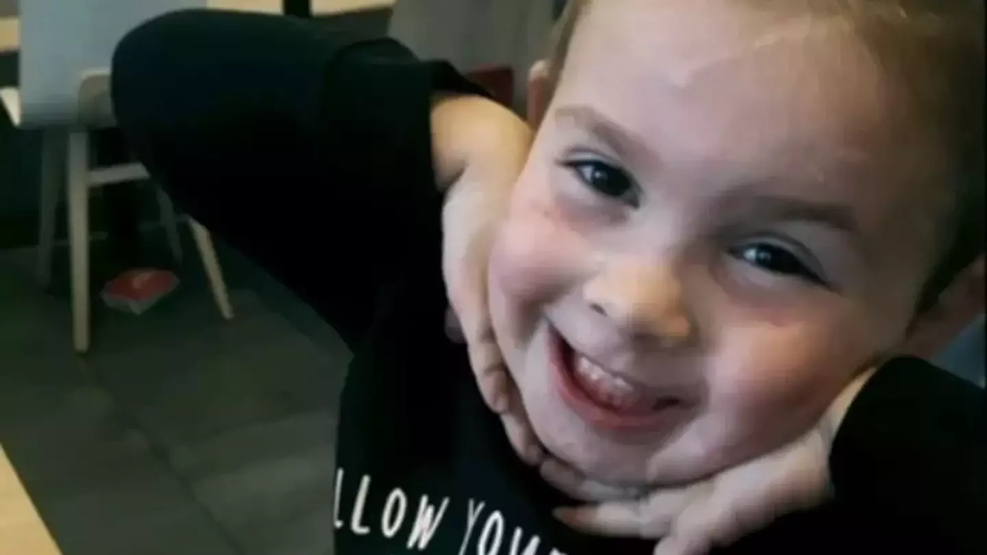 Two-year-old Ella was mauled by five dogs.