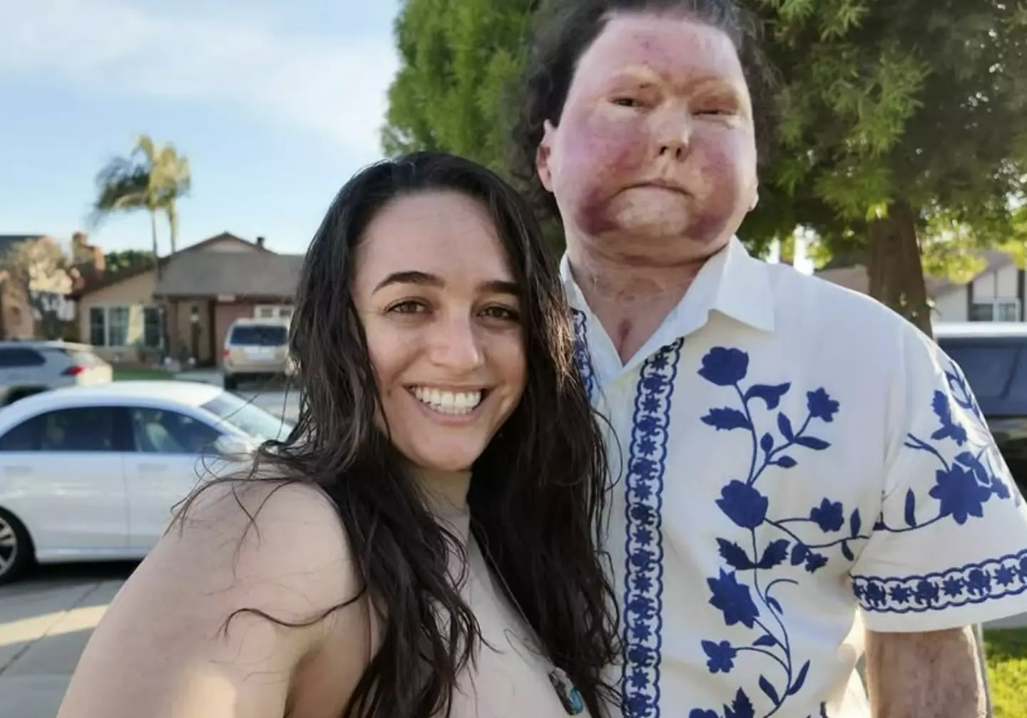 Joe met his now wife Jessica after his accident when she messaged him on Instagram (Instagram/@joeroydimeo)