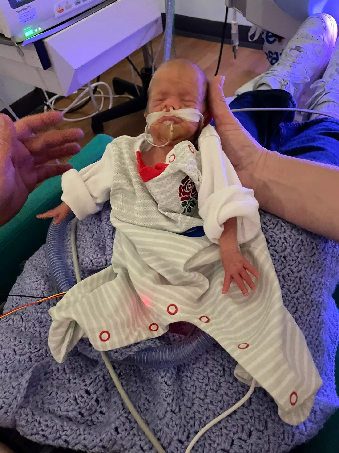 Baby George was born at just 28 weeks.