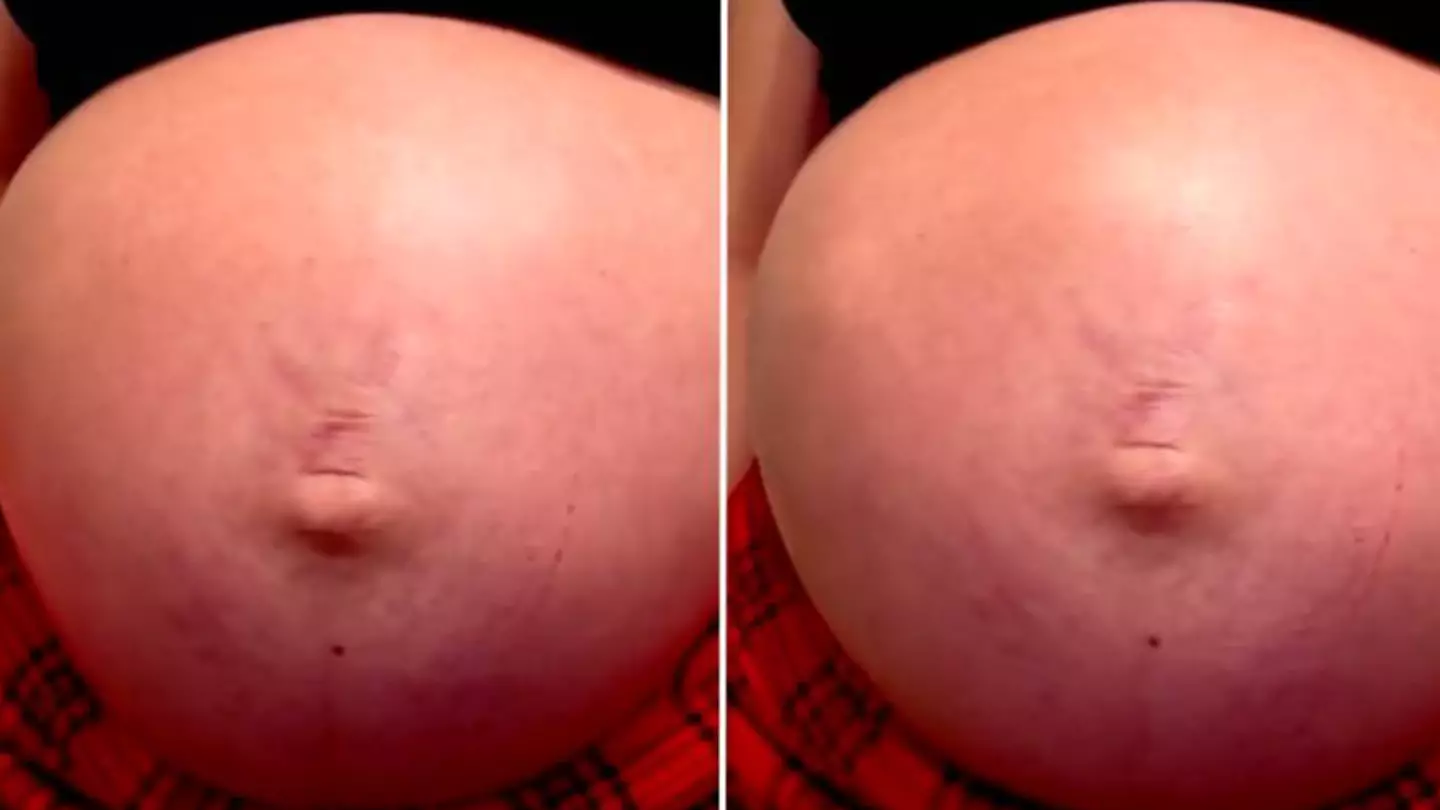 Mum shares incredible moment baby stands up inside her stomach