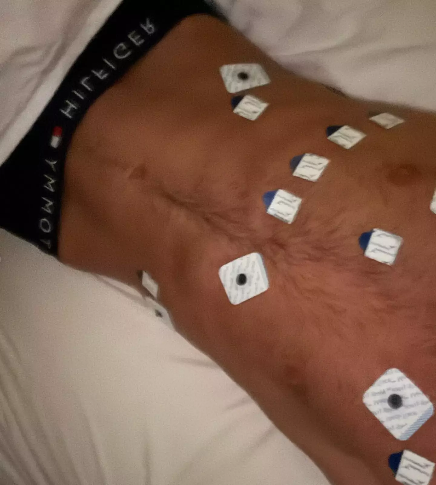 Fraser said he will 'never' use a vape ever again following the health scare (Instagram/@fraserolender)