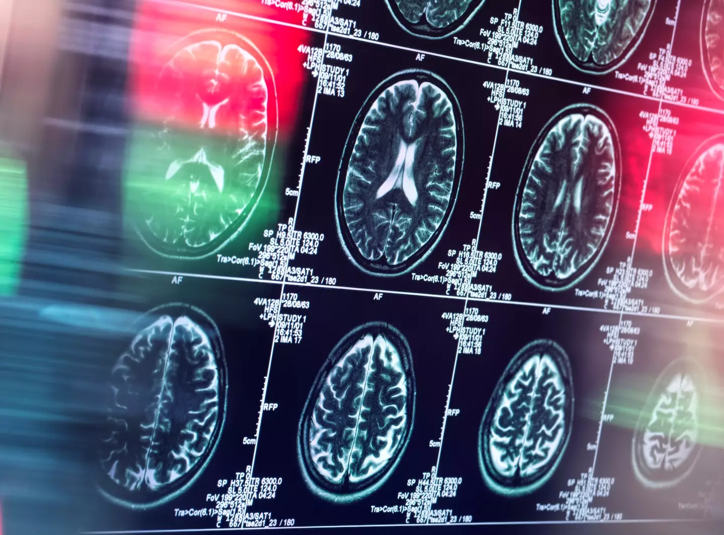 Psychopaths tend to have reduced empathy for others and a general interest in more violent and morbid material. (Getty Stock Image)