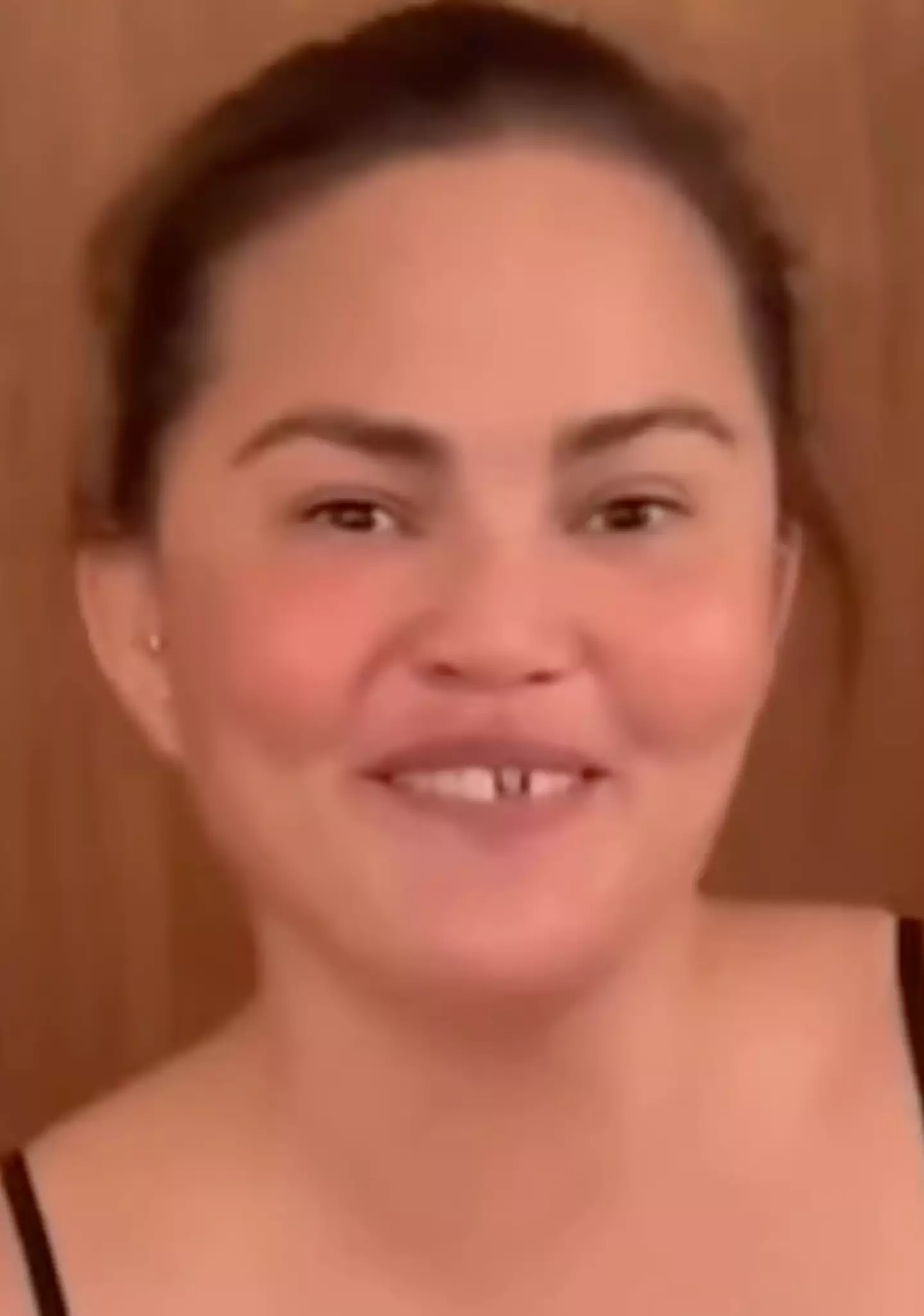 Chrissy explained that one of her two front teeth veneers came off (Instagram/@chrissyteigen)