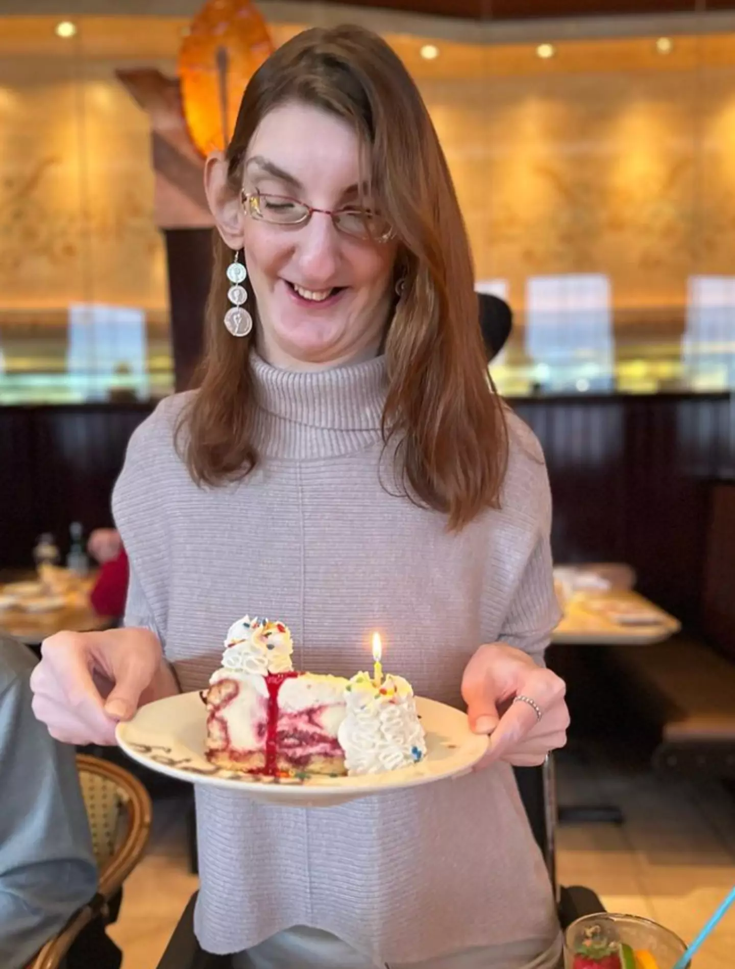 The Turkish woman has Weaver syndrome. (Instagram/@rumeysagelgi)