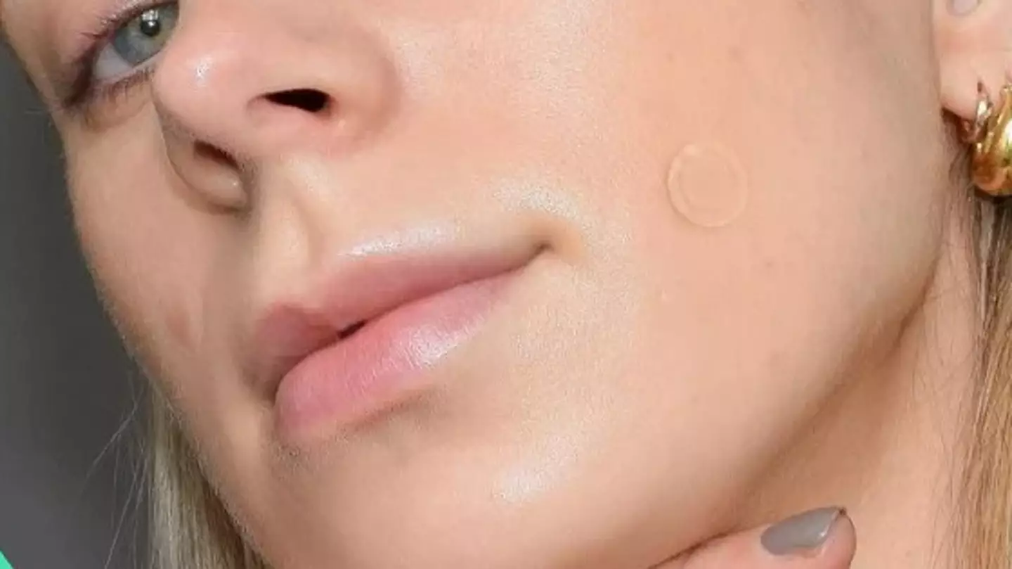 Dots for Spots