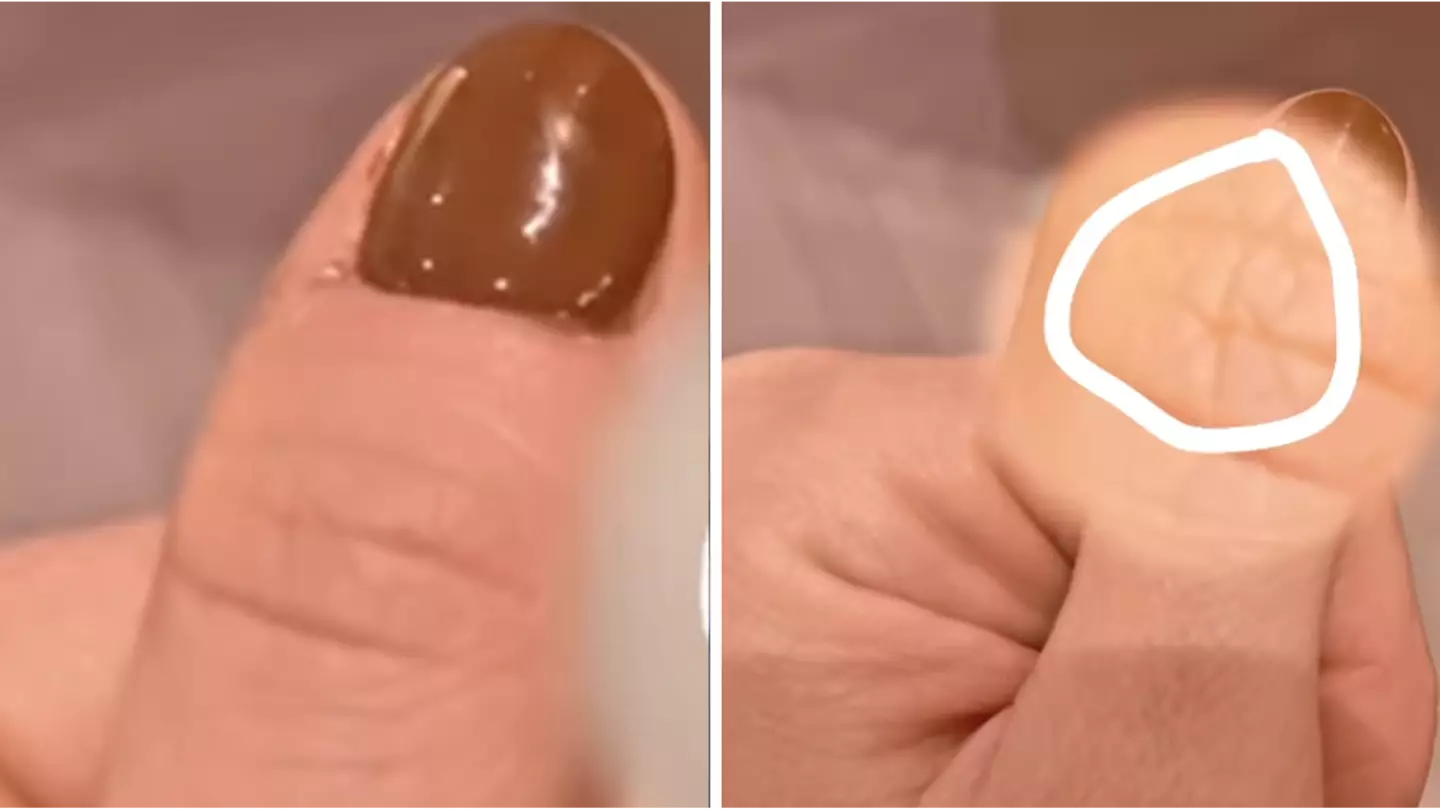 People Are Shook After Spotting 'Soulmate's Initial On Their Thumb'