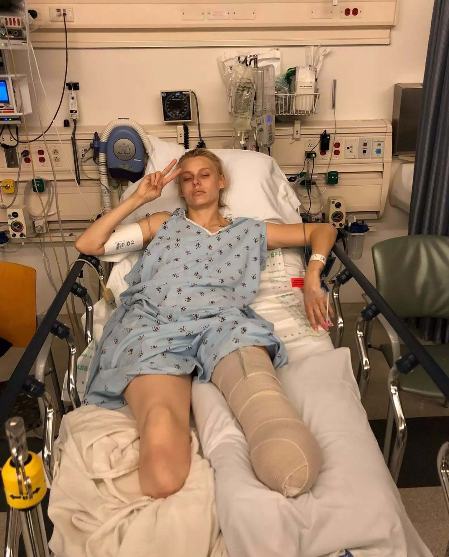 Laura eventually had to have both legs amputated.