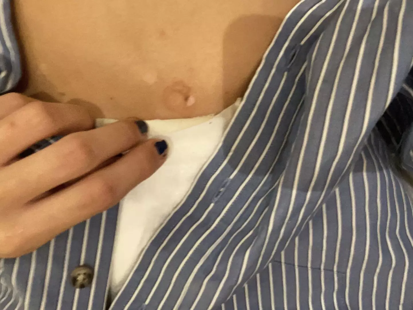 One scar was even in the shape of a hoop. (Kennedy News and Media)